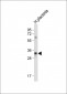LIN28B Antibody (Center)